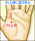 向上線に島(アイランド)がある