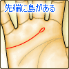 ̐[ɓ(ACh)
