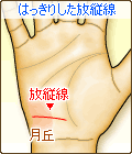 はっきりした放縦線