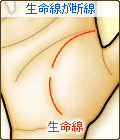 生命線が断線する
