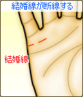 結婚線が断線する