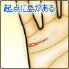 結婚線の始点に島(アイランド)がある