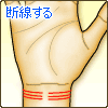 手首上にある線が断線する